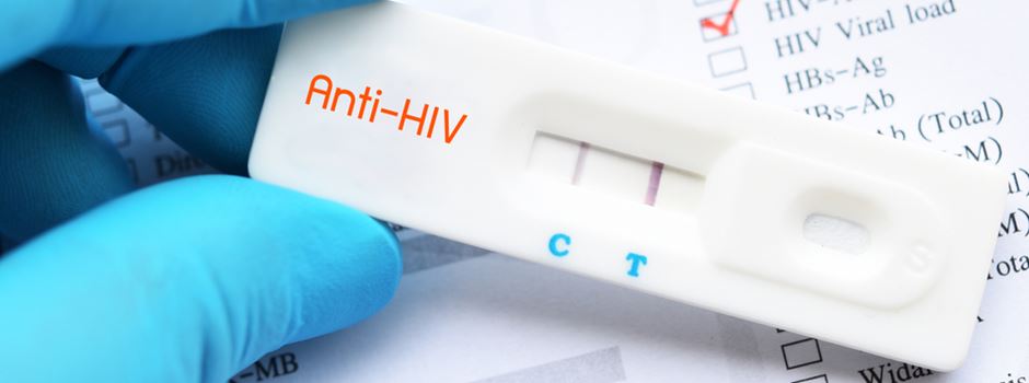 So kommt der neue HIV-Selbsttest in Frankfurt an