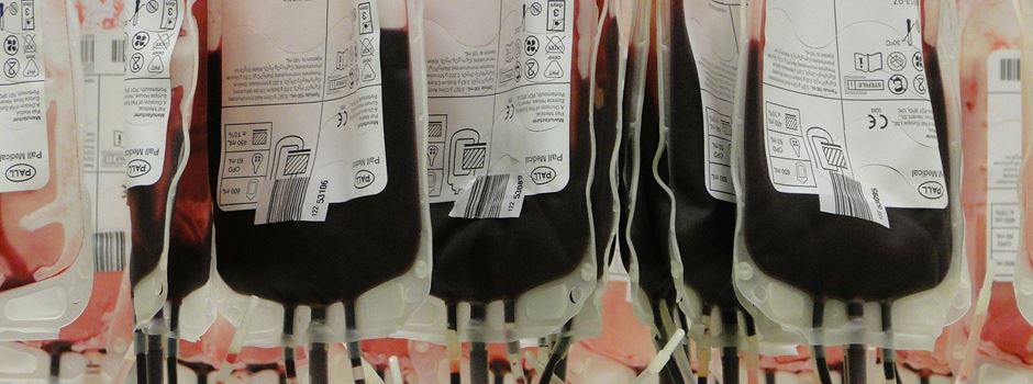 Homosexuelle dürfen kein Blut spenden, sagen die Richtlinien